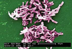  an image of the Clostridium Difficile bacteria